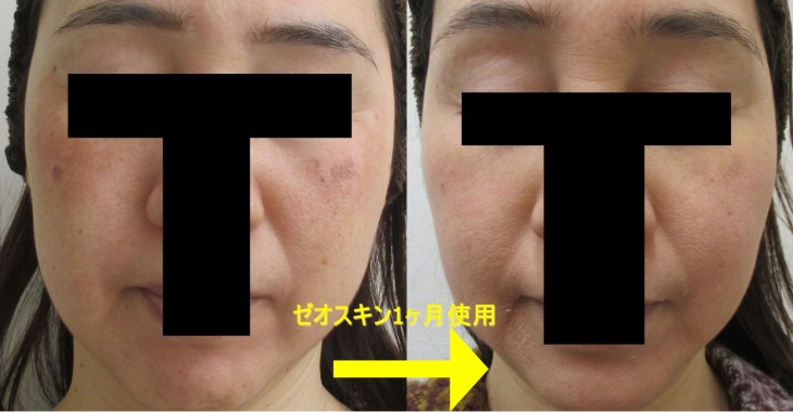 正面比較