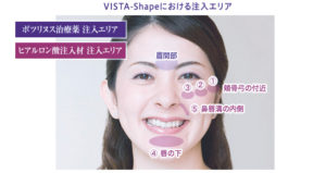 注入エリア