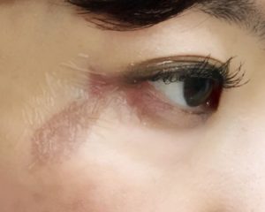 エアウォール　拡大