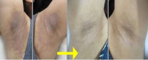 連結