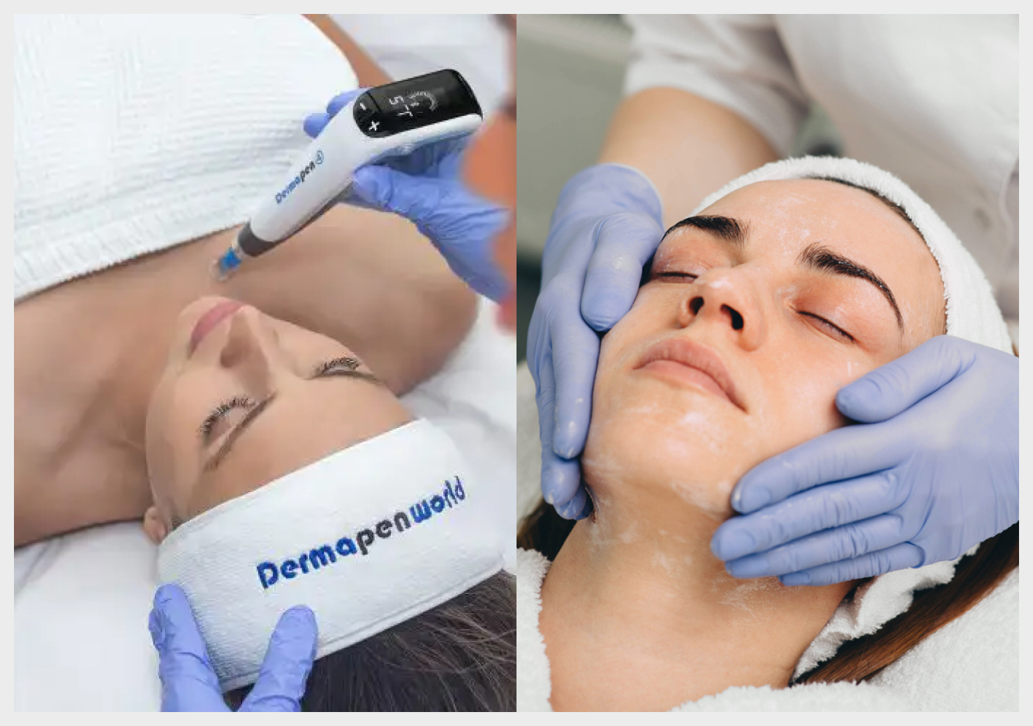 ダーマペン＆ミラノリピール (Bio Re Peel Cl3)のサムネイル画像